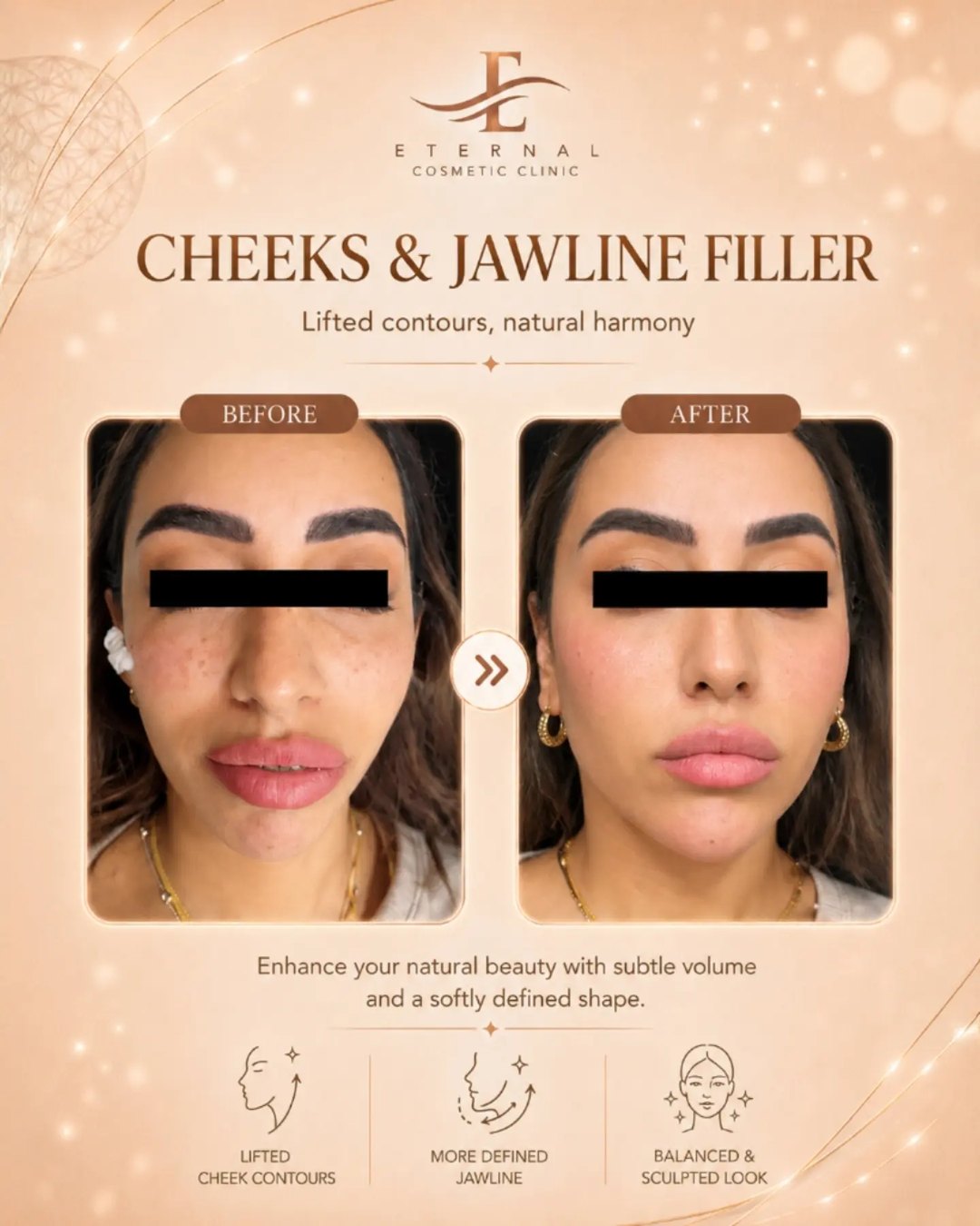 Eternal Cosmetic Clinic before and after result