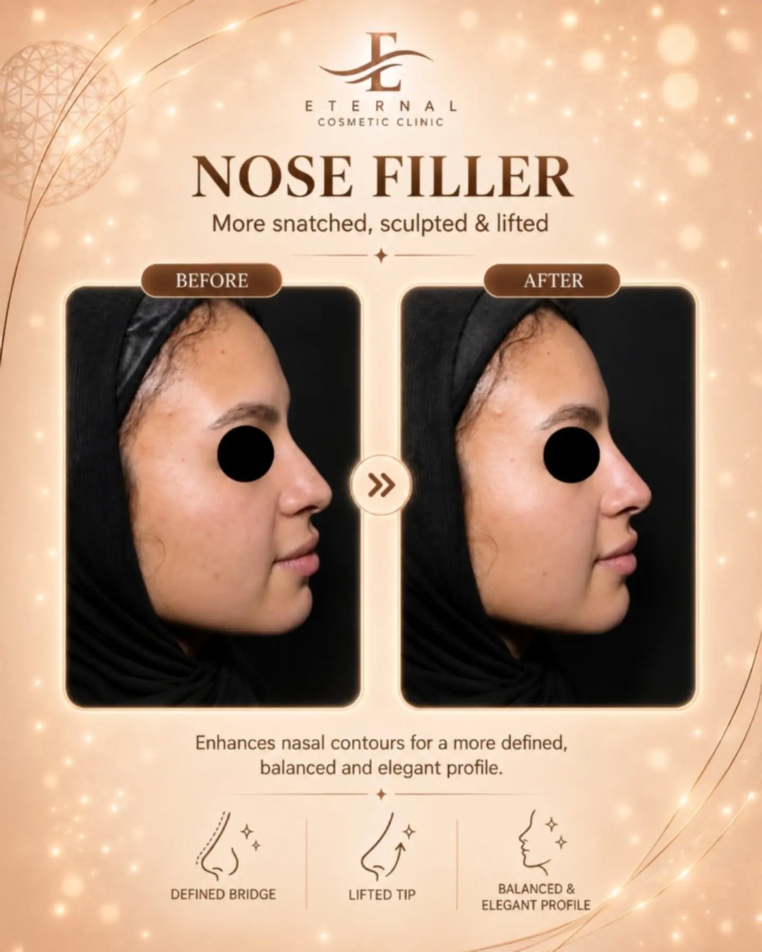 Eternal Cosmetic Clinic before and after result