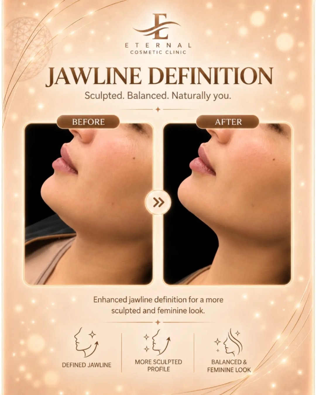 Eternal Cosmetic Clinic before and after result
