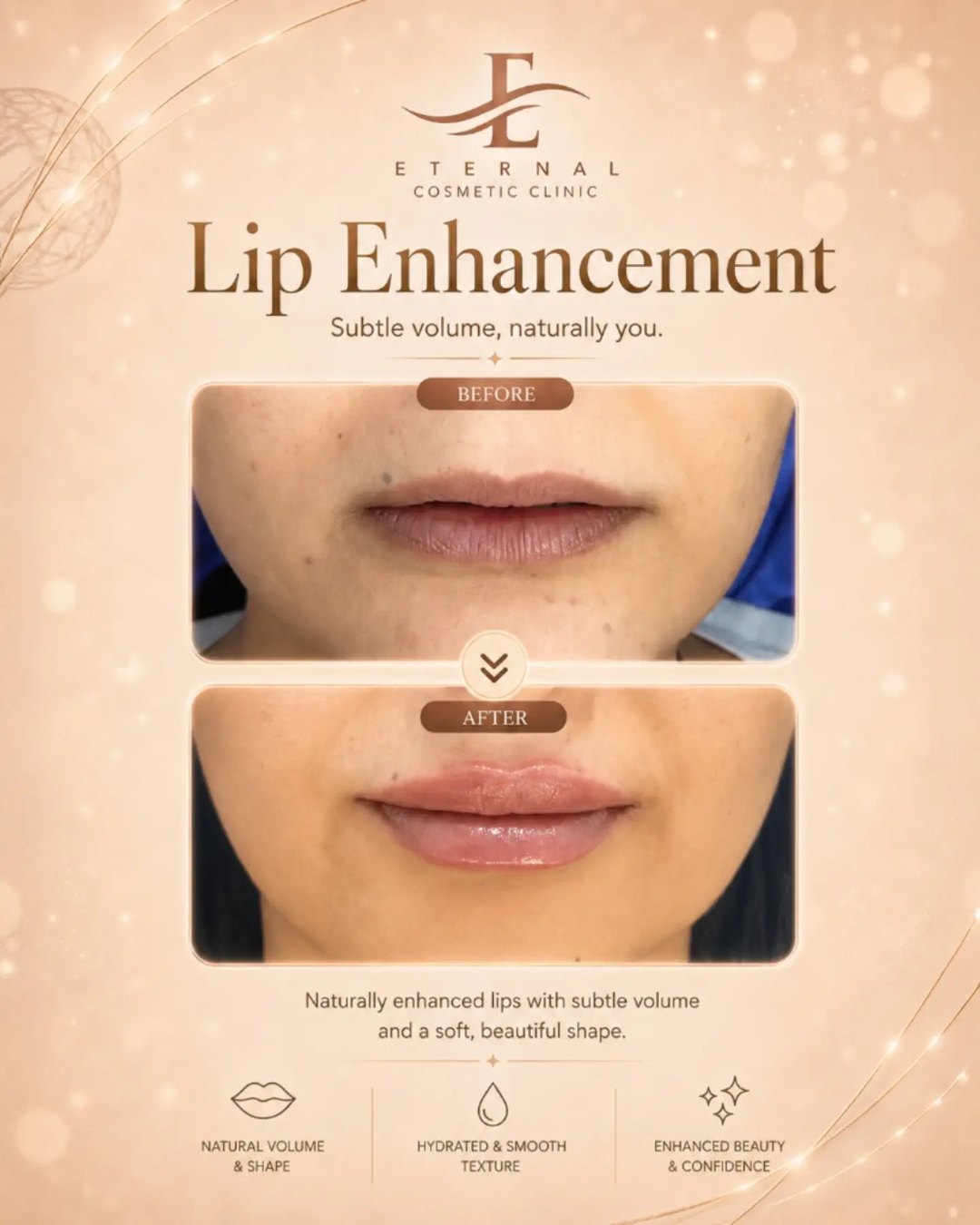 Eternal Cosmetic Clinic before and after result
