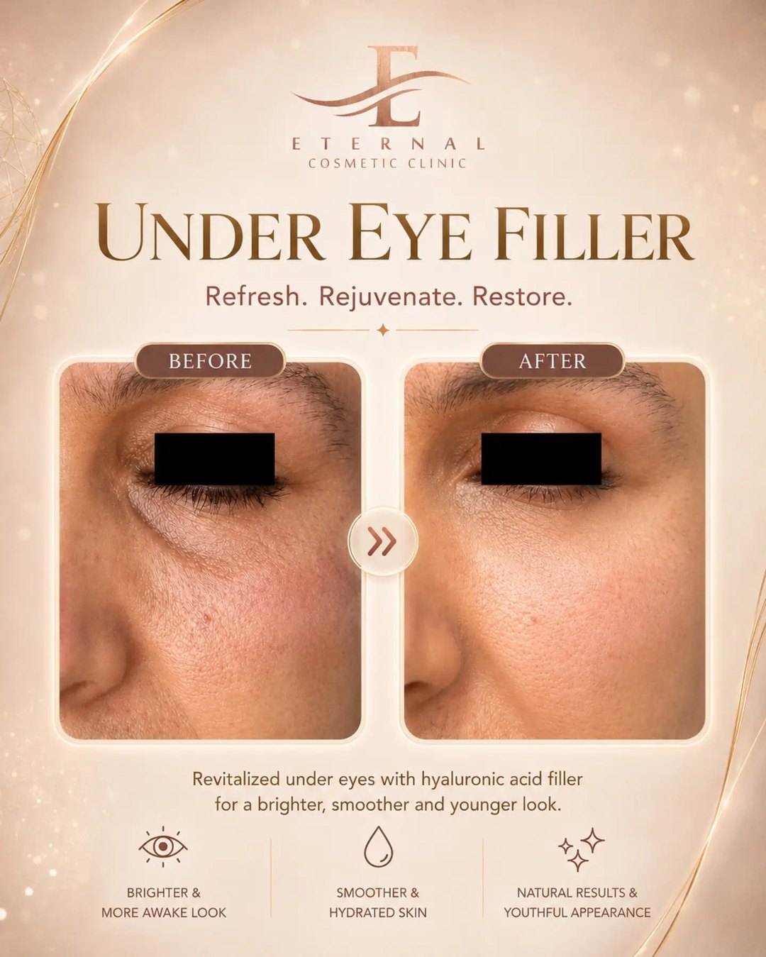Eternal Cosmetic Clinic before and after result